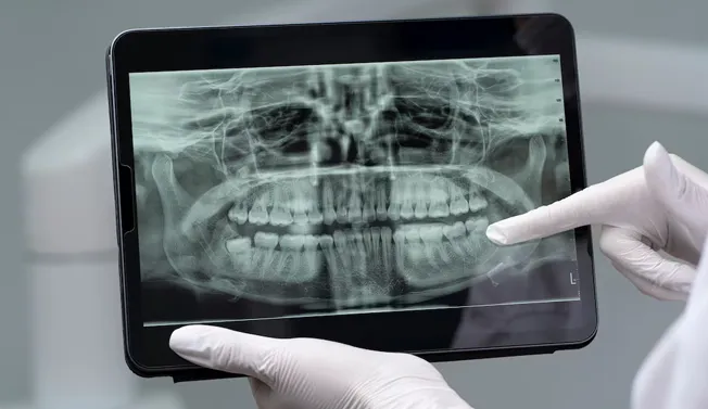 Technological Precision