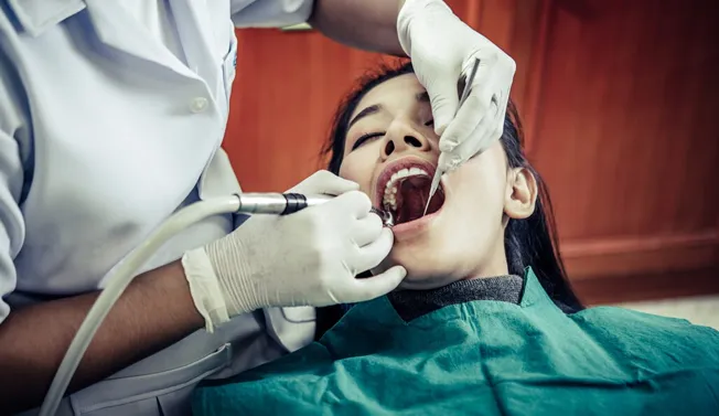 Wisdom Teeth Removal