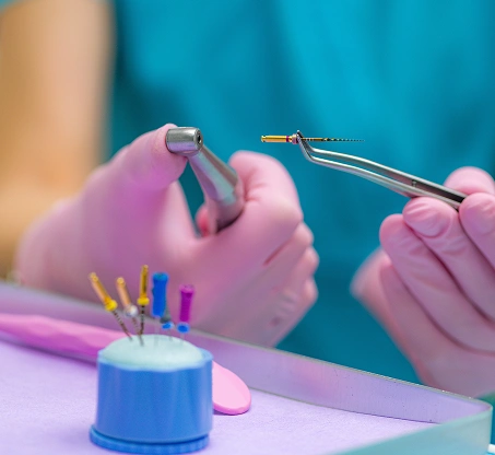 Endodontics Services